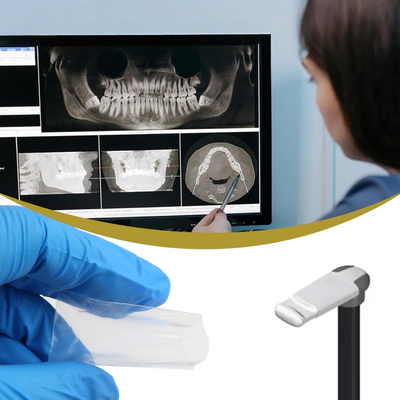200 sztuk/pudełko Osłonki na b – Photography Dental recenzja i cena