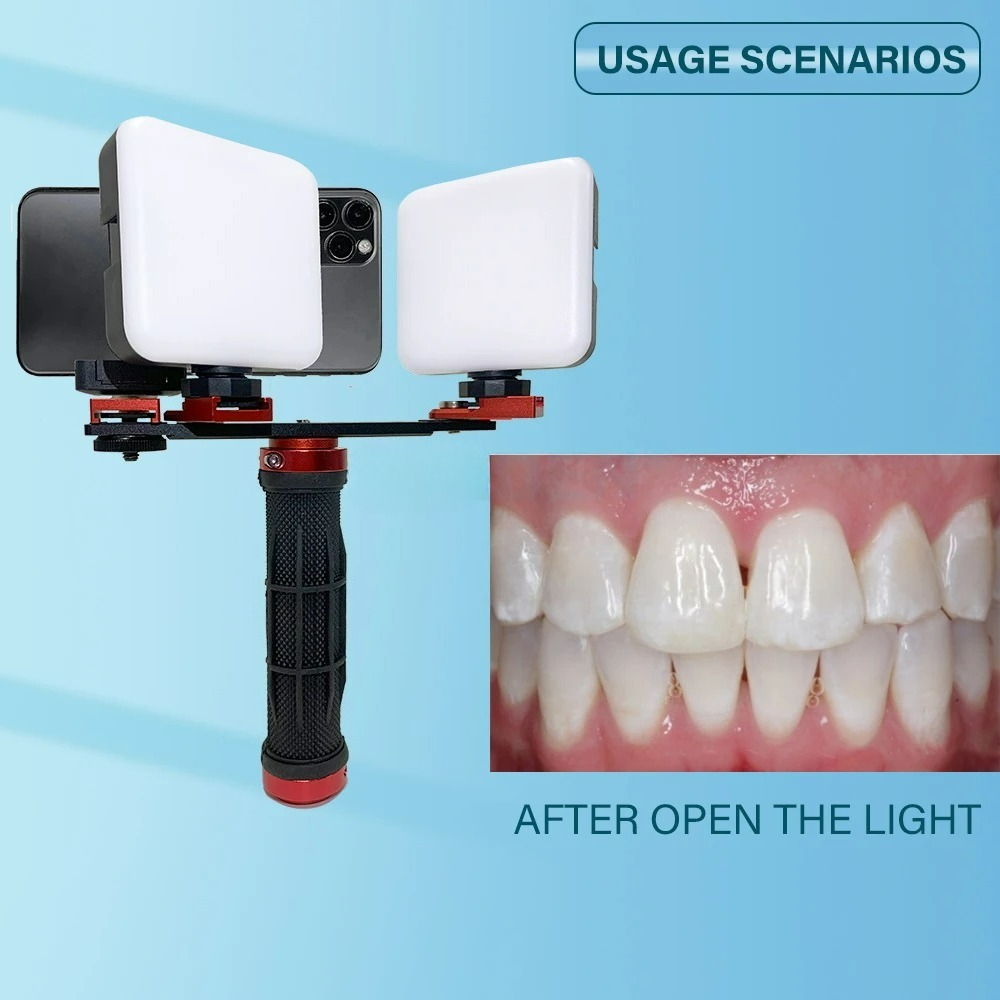 Lampa do fotografii stomatolog – Photography Dental recenzja i cena