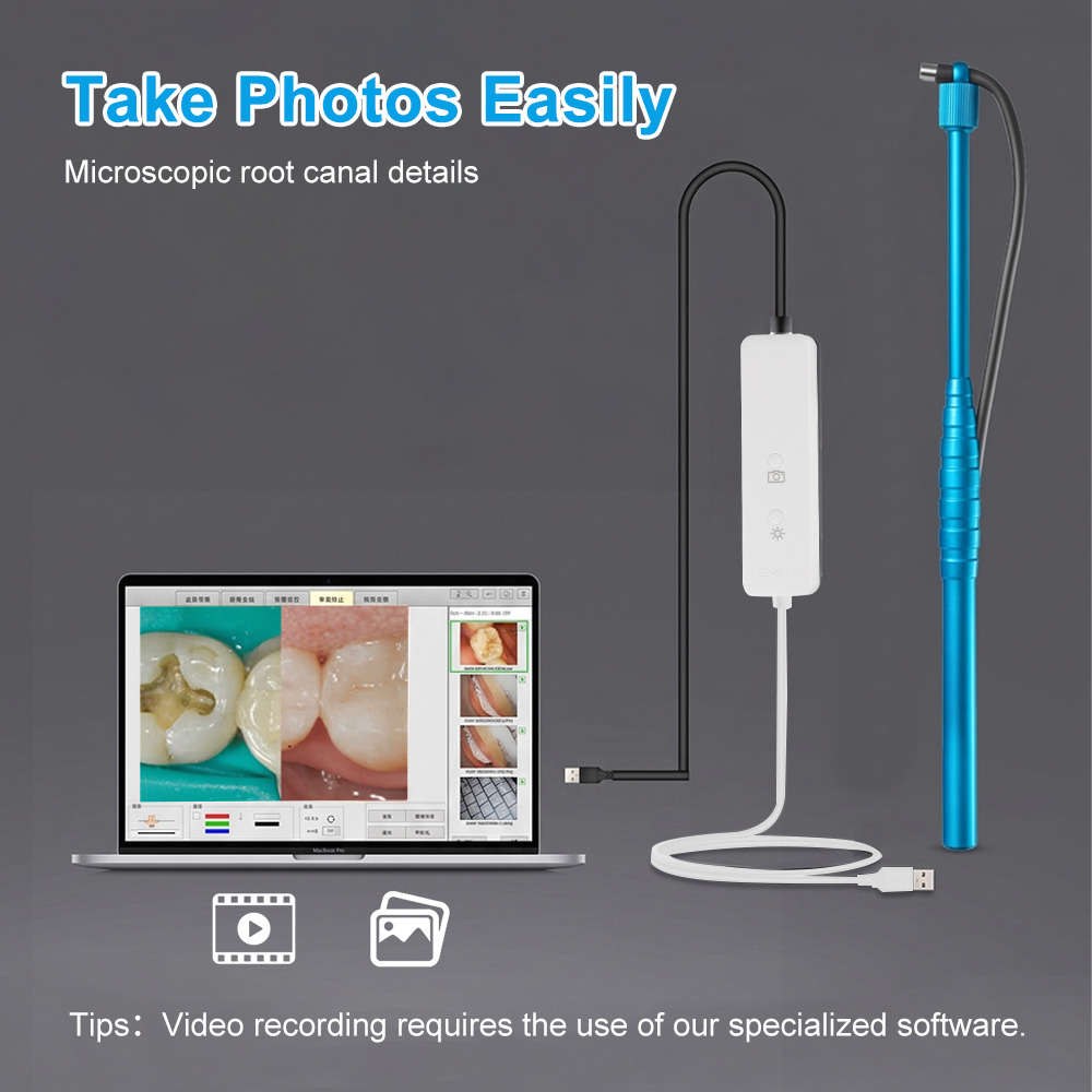 5MP Mikro Kamera Intraoralna D – Photography Dental recenzja i cena