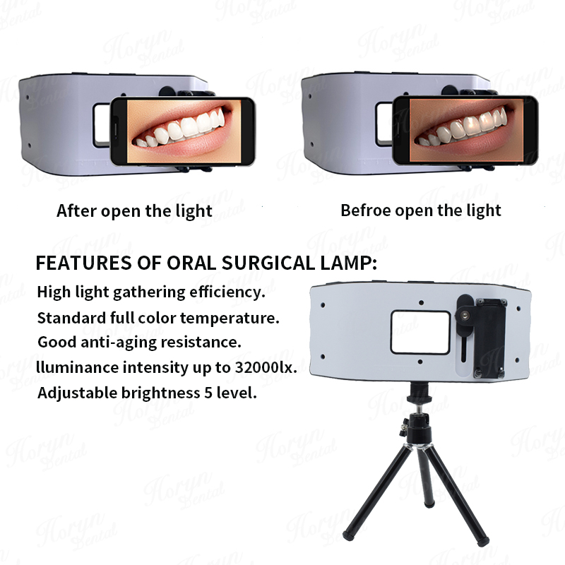 Dental Flash Light Sprzęt foto – Photography Dental recenzja i cena