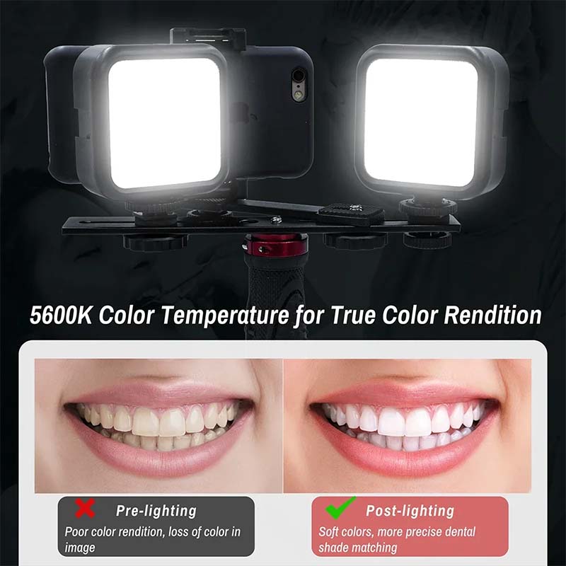 Lampa do fotografii dentystycz – Photography Dental recenzja i cena